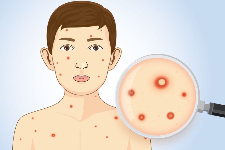 650 Warga Pesisir Paser Jadi Sasaran Skrining Penyakit HIV-TB, Pemeriksaan Masih Berlanjut